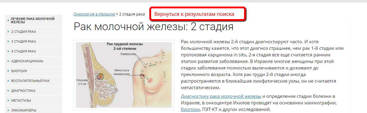 Изображение из отчета: возврат к результатам поиска на oncocenter-ichilov.com